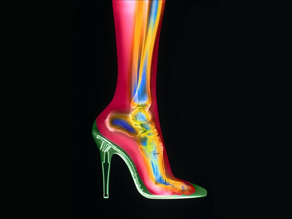 x-ray_vision__high_heel_shoe_and_foot.